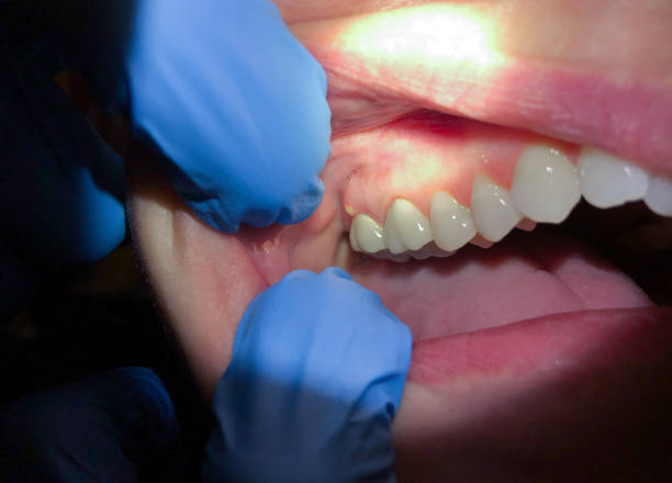 Best Cosmetic Emergency Dentistry in Marinette, WI
